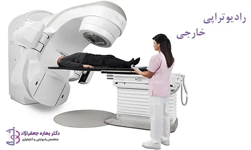 رادیوتراپی خارجی