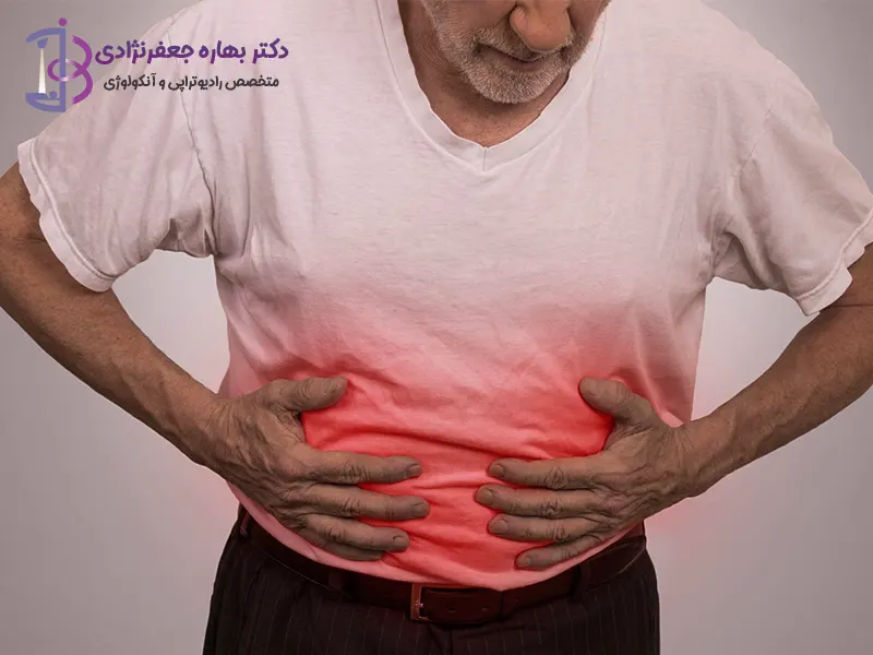 سرطان روده