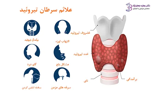 علائم سرطان تیروئید