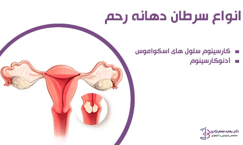 انواع سرطان دهانه رحم
