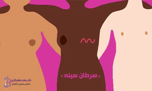 سرطان سینه