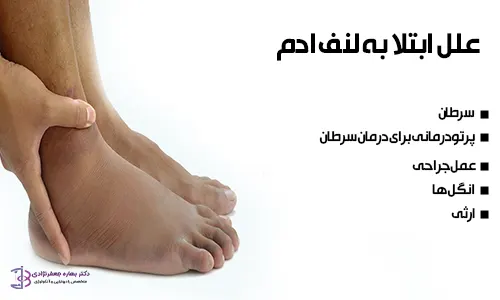 علل ابتلا به لنف ادم