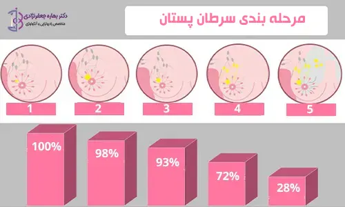 مرحله بندی سرطان پستان
