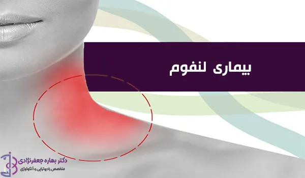 بیماری لنفوم