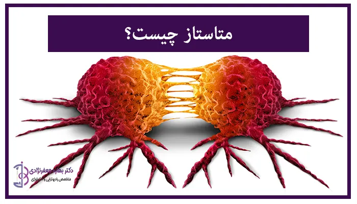 متاستاز چیست؟