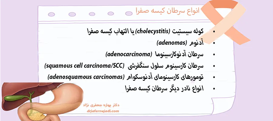 انواع سرطان کیسه صفرا