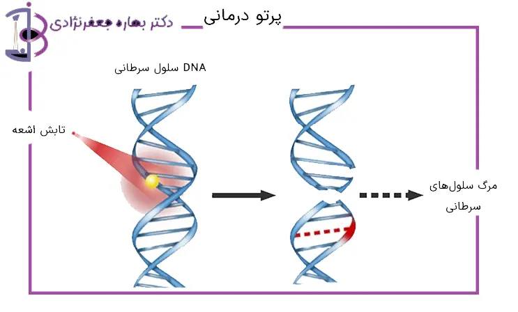 عملکرد پرتودرمانی