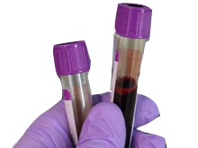 آزمایش Oncotype DX