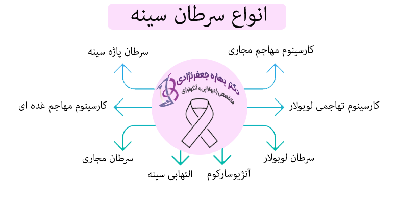 انواع سرطان سینه