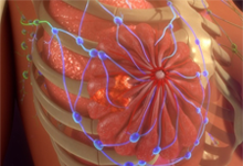 کارسینوم مجاری